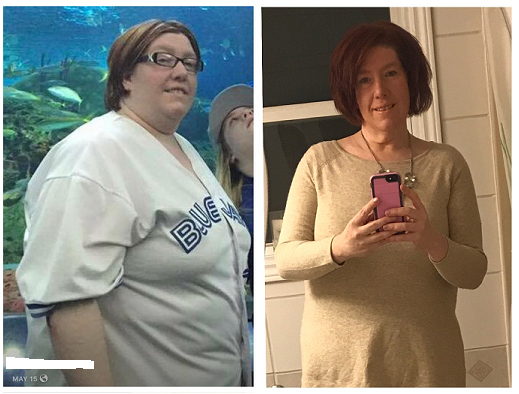 angela michaud feb 2018 before after