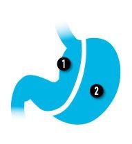 gastric sleeve stomach diagram