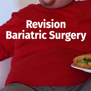 smartshape revision bariatric surgery