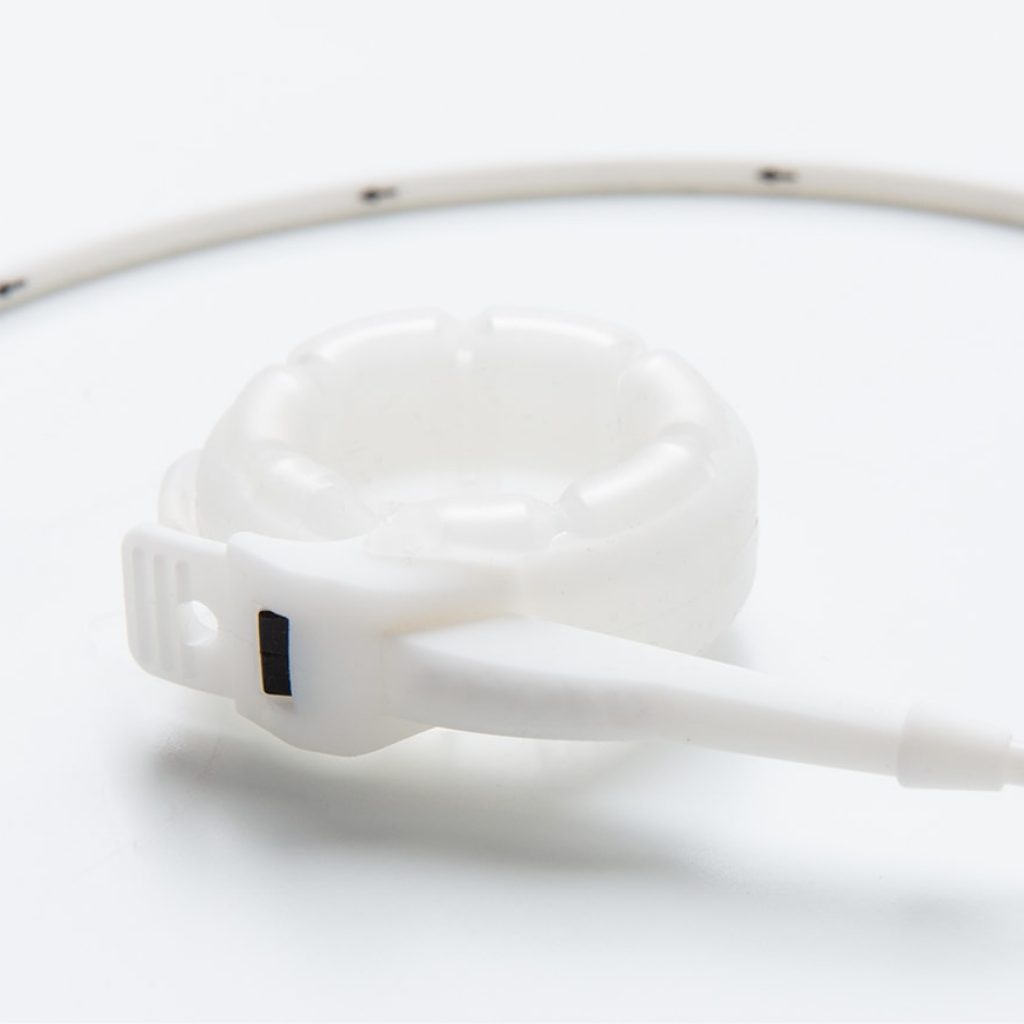 LAPBAND® Surgery in Toronto, Ontario, Canada SmartShape Weight Loss Centre